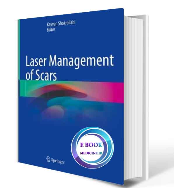دانلود کتاب Laser Management of Scars2020 (Original PDF) 